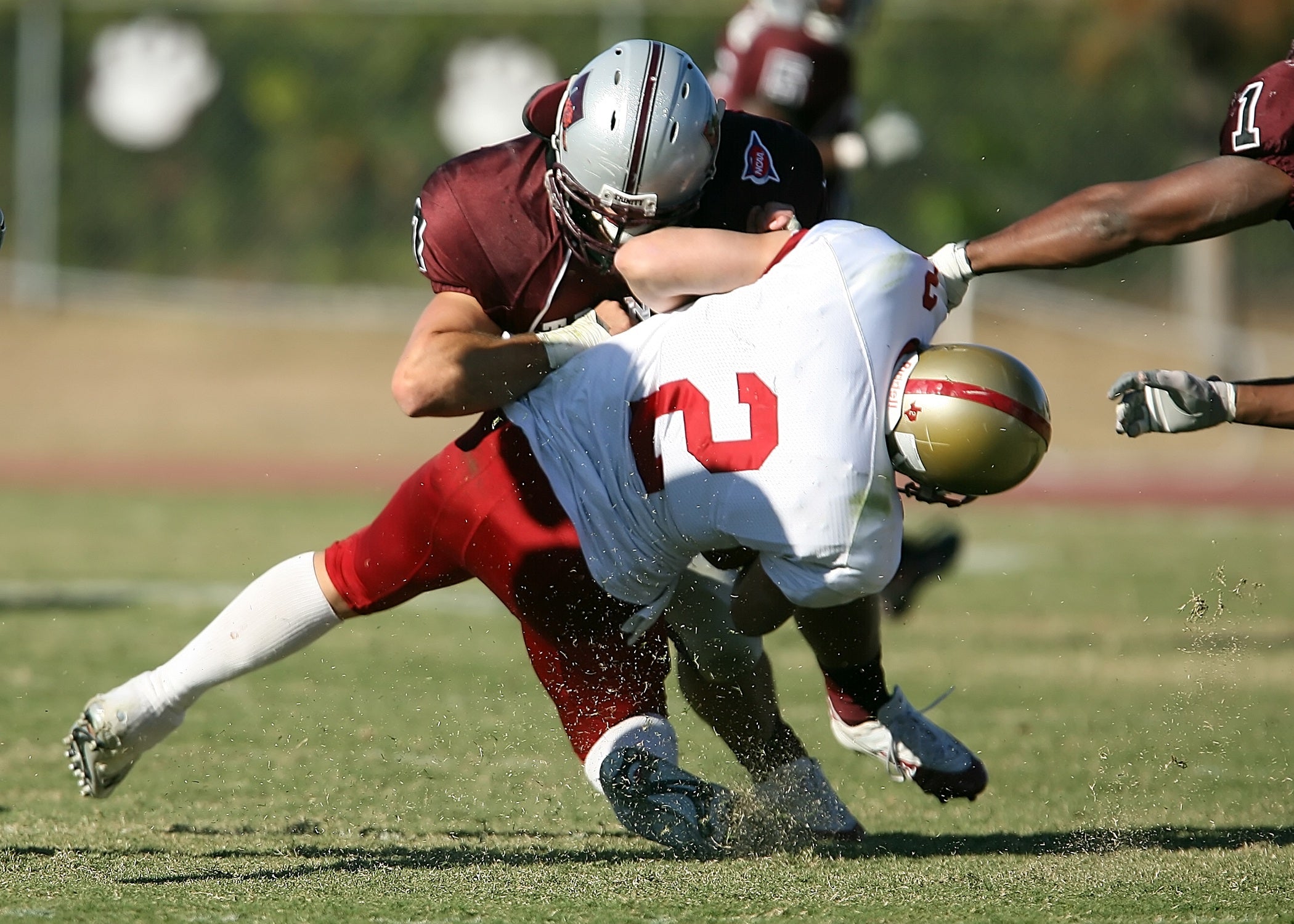 Don't Let Spooky Sports Injuries Haunt Your Halloween: A Guide to Game On Mouthguards